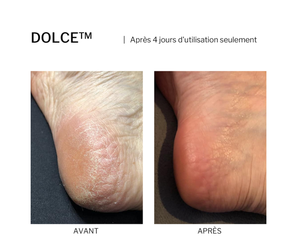 DOLCE™ · Baume réparateur mains et pieds